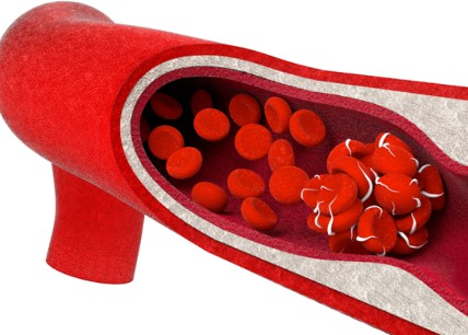 Cum afectează coronavirusul intestinul prin formarea cheagurilor de sânge
