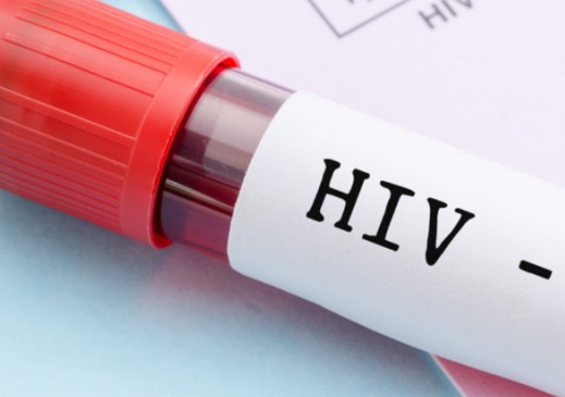 UNHOPA: Normele tehnice de realizare a Programului Naţional HIV/SIDA trebuie aduse în anul 2022