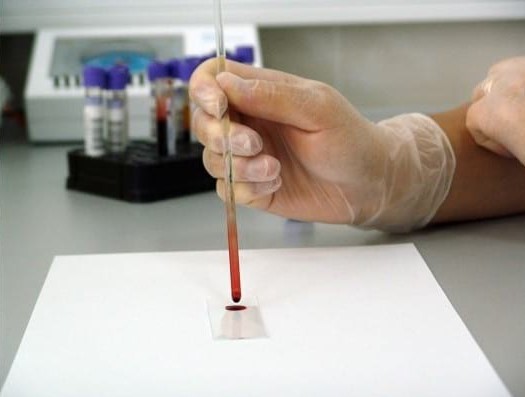 Teste și analize obligatorii pentru un bărbat