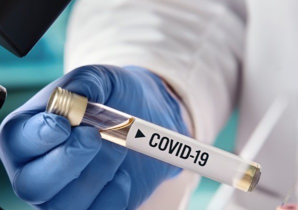 Rezultat promiţător asupra maimuţelor al vaccinului anti-COVID-19 dezvoltat de americani
