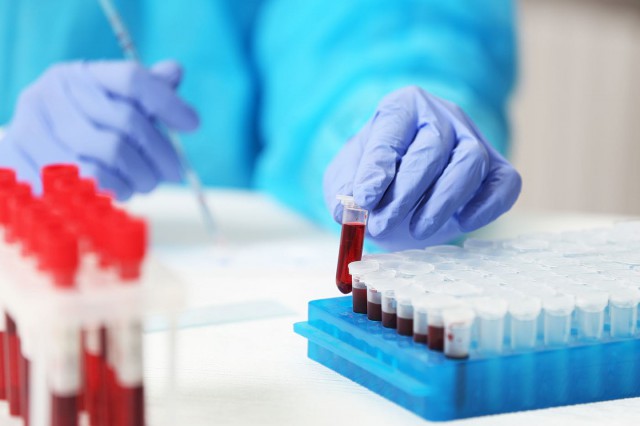 Cancerul, depistat cu 4 ani înainte de apariția simptomelor?