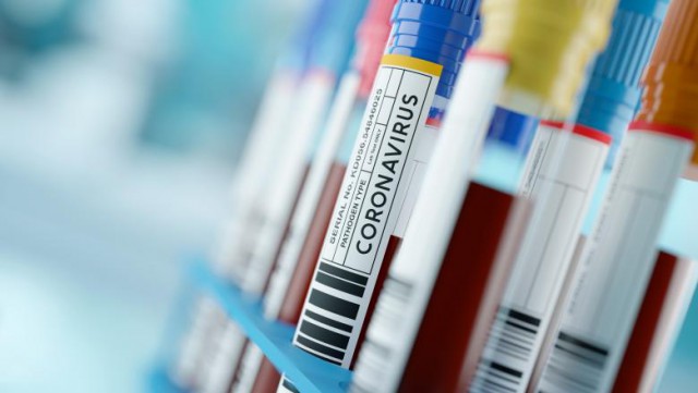 Șefa Societății de Epidemiologie: Suntem într-o fază de transmitere comunitară susținută