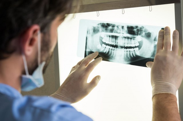 Radiografia dentară: ce rol are, câte tipuri există și ce efecte are asupra sănătății
