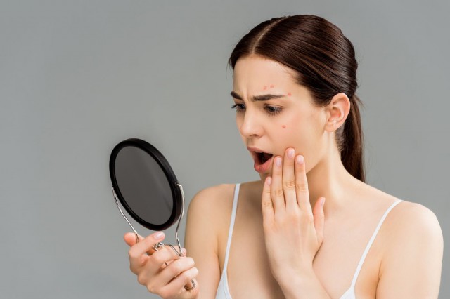 Acnee, lupus, vitiligo, psoriazis: care sunt efectele soarelui asupra acestor afecțiuni?