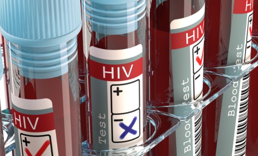 Cercetătorii au descifrat modul în care anumiţi oameni reuşesc să ţină HIV sub control fără tratament