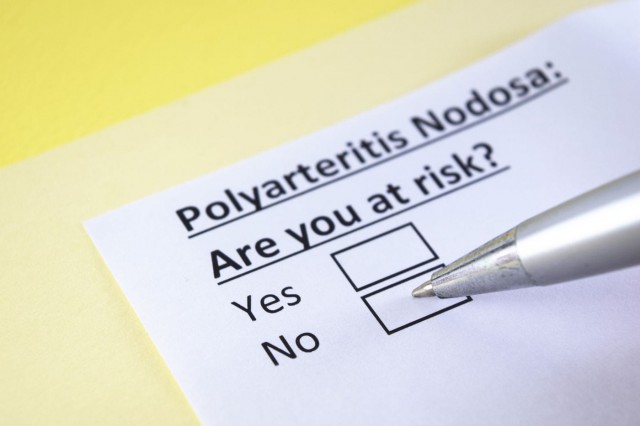Poliarterita nodoasă: ce este, simptome și tratament