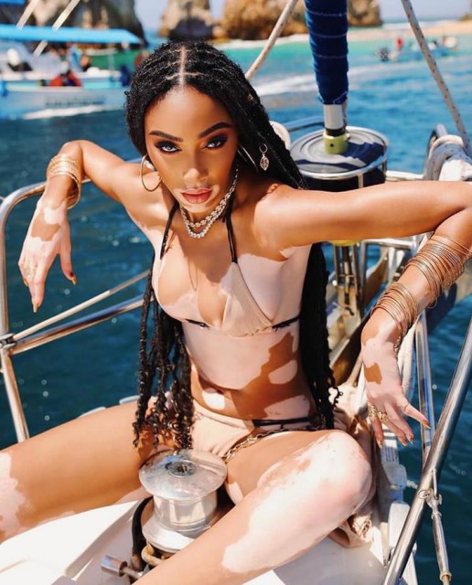 Cine este Winnie Harlow, fata care a făcut carieră în modelling deşi suferă de vitiligo