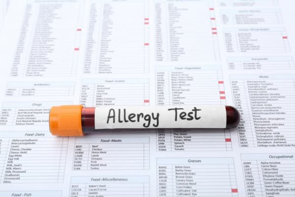 Studiu: Un nou test de sânge ar putea depista alergia la arahide fără riscuri