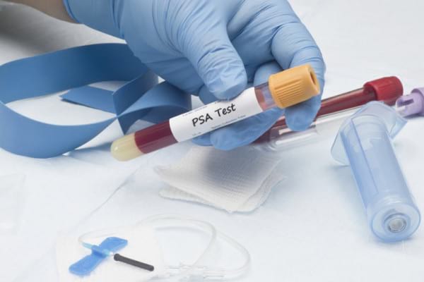 Controlul urologic anual: când se recomandă și ce presupune