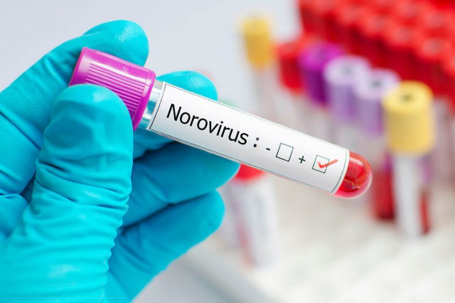 Infecția cu norovirus: simptome, tratament, prevenție