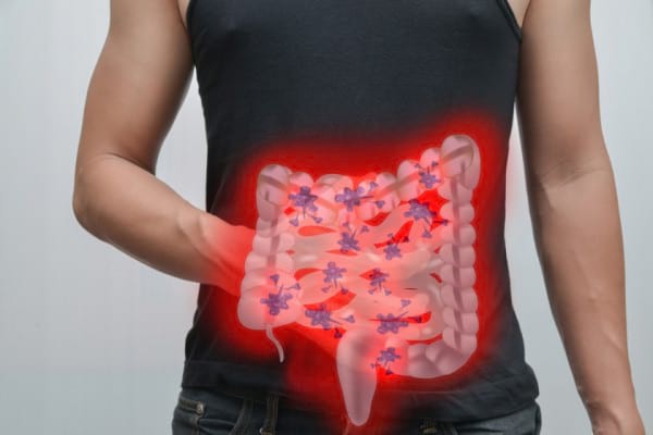 Paraziții intestinali la copii, dar și la adulți
