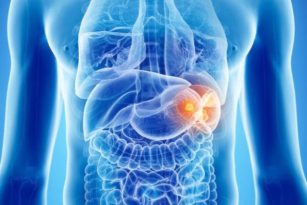 Splenomegalia, complicație a hepatitei C