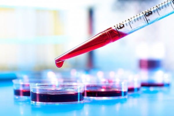 Interpretarea valorilor transaminazelor: ce ne 