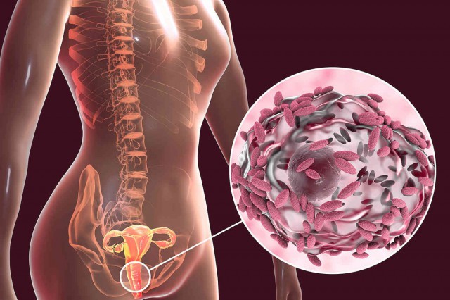 Cum restabilești echilibrul florei vaginale