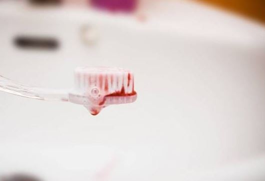 Nu ignora sângerarea gingiilor! Iată de ce