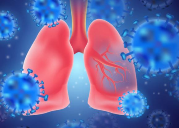 Leziunile pulmonare descoperite la pacienţi decedaţi dezvăluie informaţii despre „Covid-ul de lungă durată”