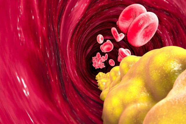 Ce impact are colesterolul asupra membranelor celulare
