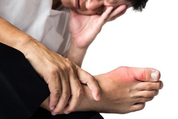 Acizii grași Omega 3 din uleiul de peste pot preveni atacurile de gută