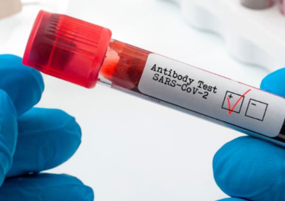 Studiu: Anticorpii împotriva SARS-CoV-2, detectaţi până la şapte luni după infectare