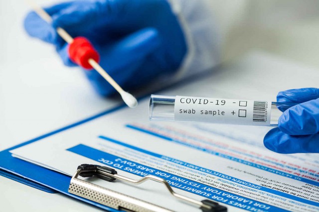 De ce apar uneori rezultate false sau neconcludente la testarea pentru noul coronavirus?