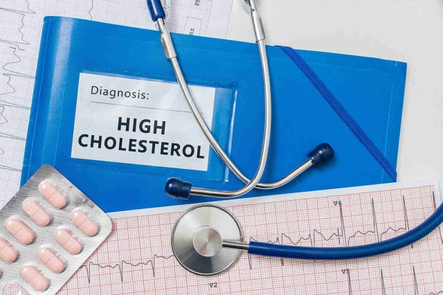 Studiu: Colesterol mărit la tinerețe, risc de probleme cardiace la vârsta a doua