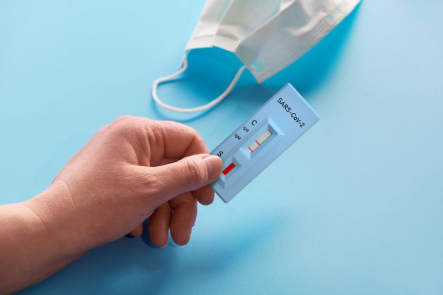 Testele rapide pentru COVID-19 pe bază de anticorpi nu ajută la stabilirea unui diagnostic precoce