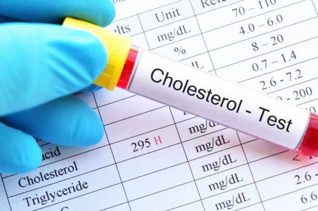 Testele genetice pentru colesterol mărit pot să te ajute să previi infarctul