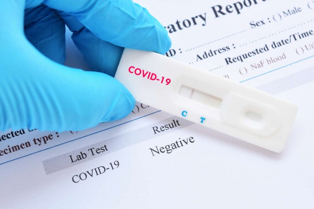 Testele pe baza detecției de antigen, instrument de încredere în diagnosticarea COVID-19