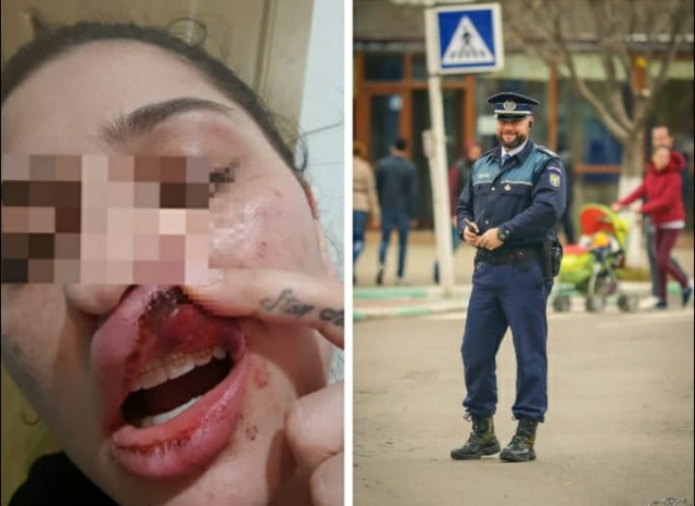 EXCLUSIV! Un POLIȚIST a DESFIGURAT în BĂTAIE o TÂNĂRĂ din NĂVODARI