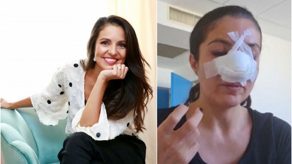 Cristina Joia, operată a doua oară la nas după ce a fost lovită violent într-un magazin