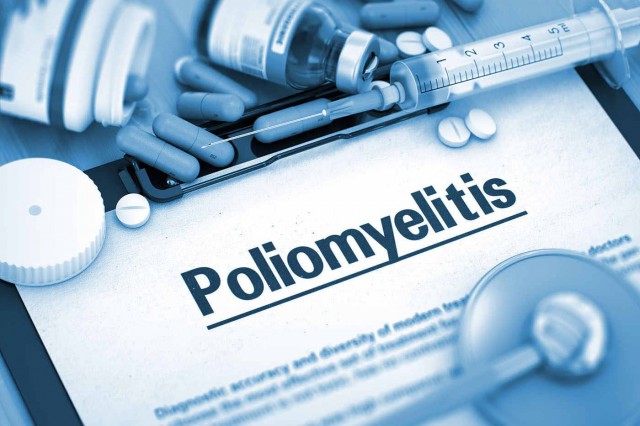 Poliomielita: tipuri, factori de risc, simptome, tratament