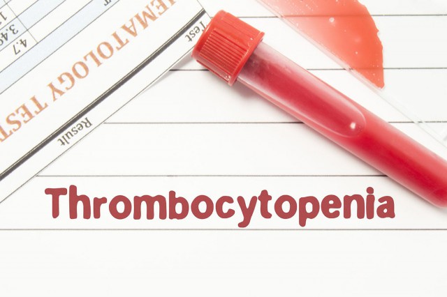 Trombocitopenia: cauze, simptome, tratament