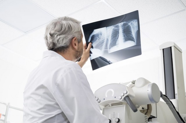 Studiu: Diabetul și poluarea, corelate cu riscul de boală pulmonară interstițială