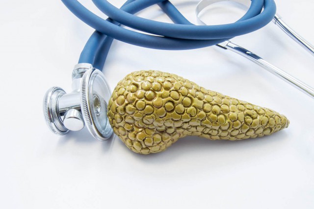 Studiu: Cancerul de pancreas: o nouă strategie de tratament?