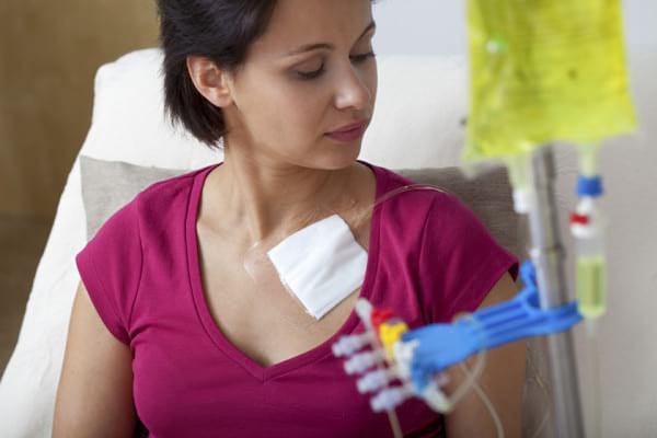 Chimioterapia pentru cancerul pulmonar și menopauza prematură