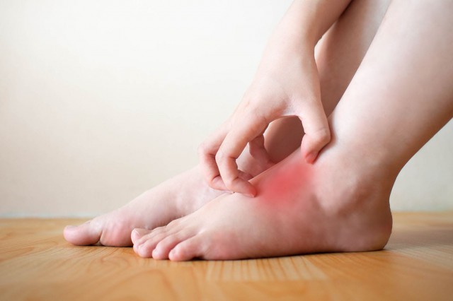 Ai mereu mâinile și picioarele fierbinți? 10 cauze posibile