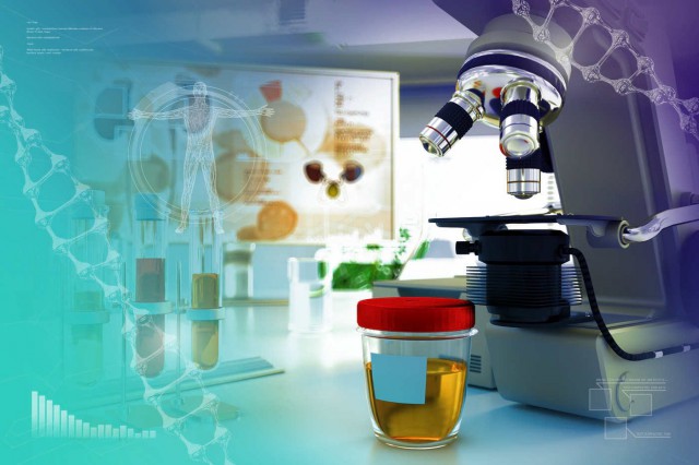 Albuminuria în diabet: simptome, diagnostic și tratament
