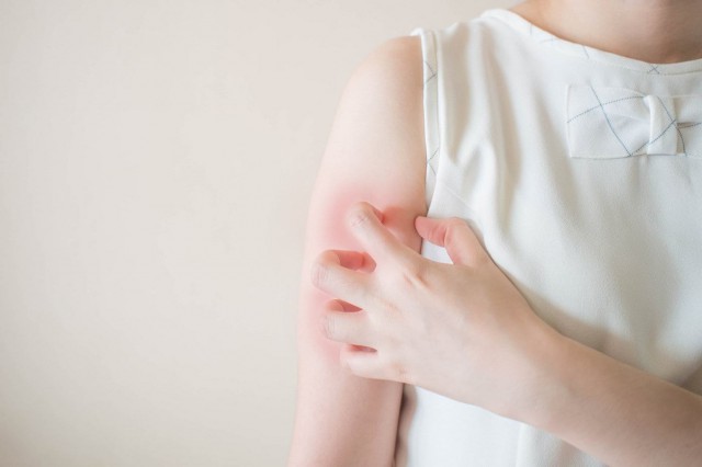 Studiu: Lipsa mișcării predispune la psoriazis?