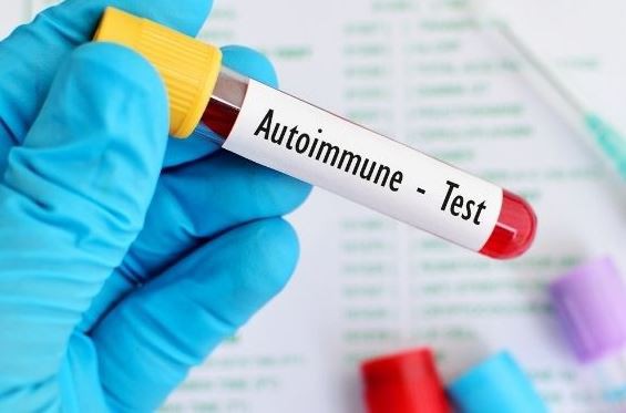 Infecția cu SARS-CoV-2 poate declanșa apariția bolilor autoimune?