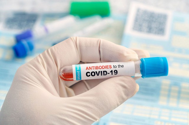 Cum poţi şti cu adevărat dacă ai fost deja bolnav de COVID-19?