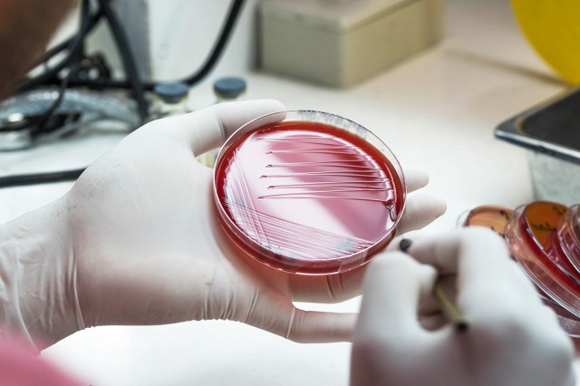 Rezistența la antibiotice se dezvoltă mai repede decât se credea