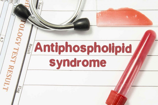 Sindromul antifosfolipidic: cauze, simptome, tratament