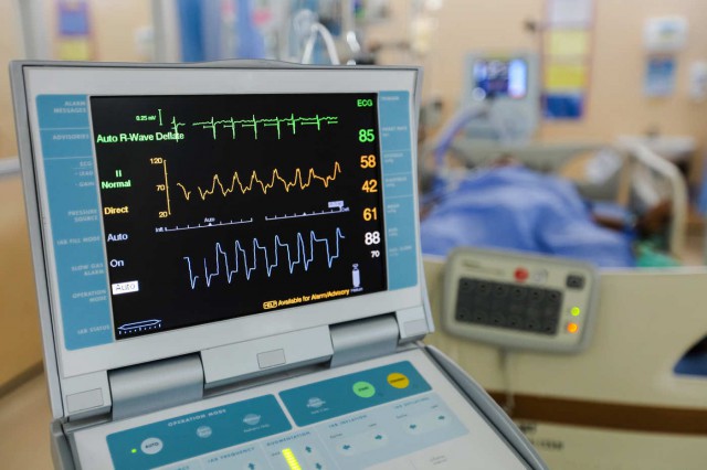 Cum se interpretează o electrocardiogramă (EKG)
