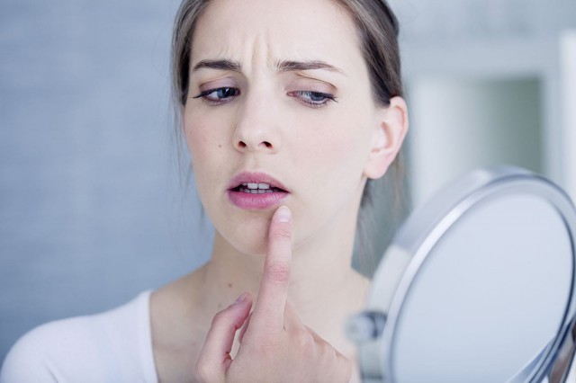 Stresul și boala declanșează episoadele de herpes. Cum are loc procesul?