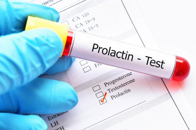 Prolactina și tulburările pe care le poate genera: cauze, simptome, tratament