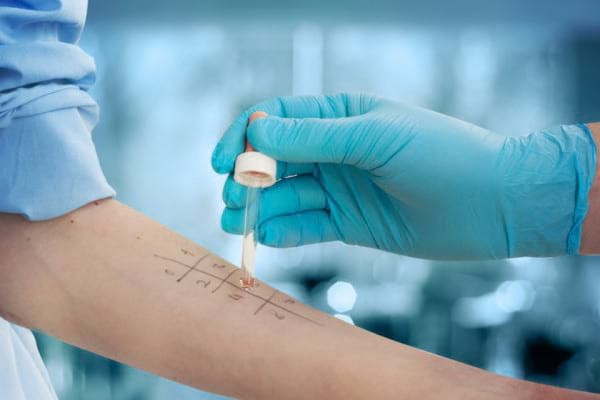 Teste și investigații pentru diagnosticarea alergiilor