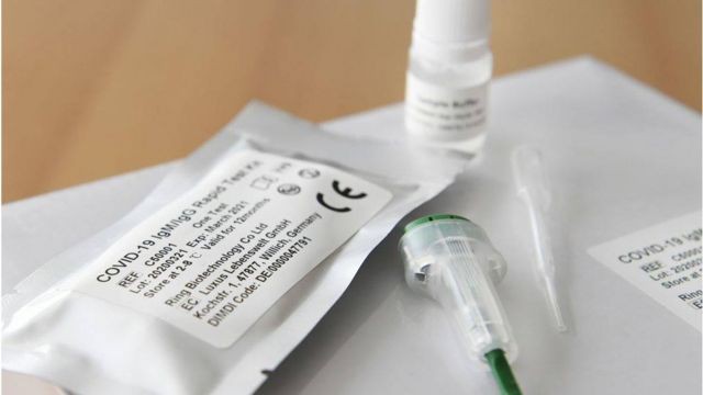 Coronavirus: Marea Britanie nu intenţionează să oprească testarea rapidă pentru COVID-19