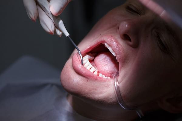 Tot mai multe dovezi leagă sănătatea gingivală de riscul de AVC