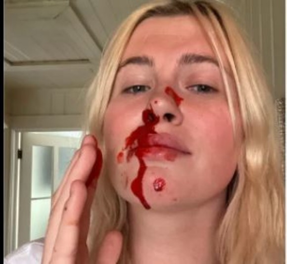 Ireland Baldwin, poză șocantă pe Instagram. Cum a ajuns cu fața plină de sânge
