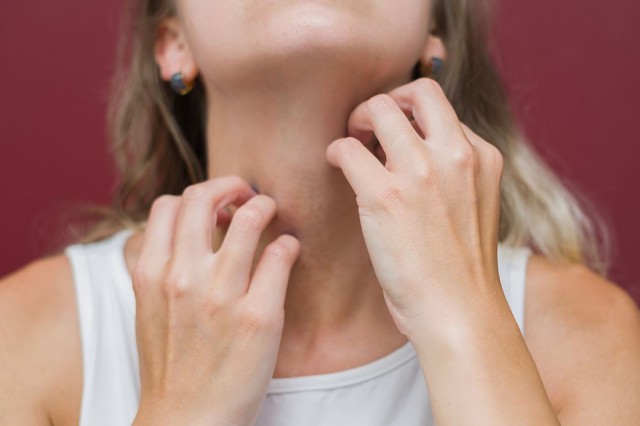 Neurodermatita: cauze, simptome, tratament